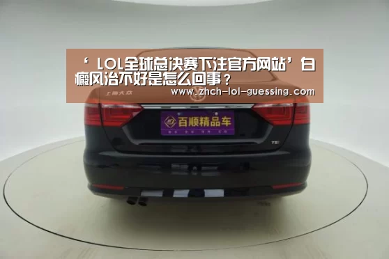 ‘ LOL全球总决赛下注官方网站’白癜风治不好是怎么回事?(图2) LOL全球总决赛下注官方网站